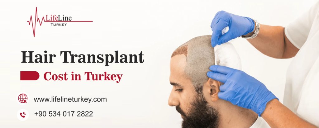How much does a hair transplant cost in turkey?