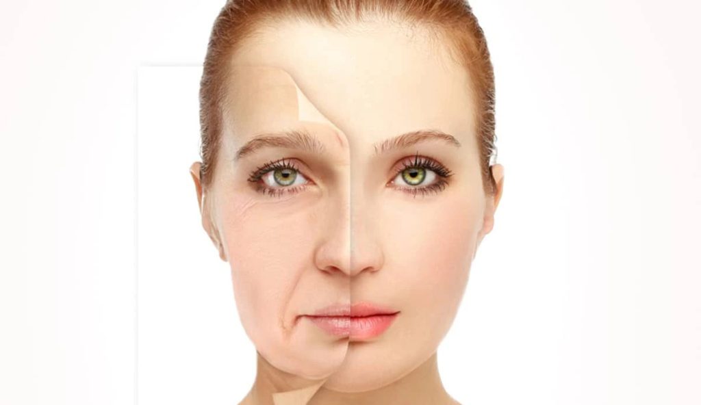 Facelifts Cost in Turkey