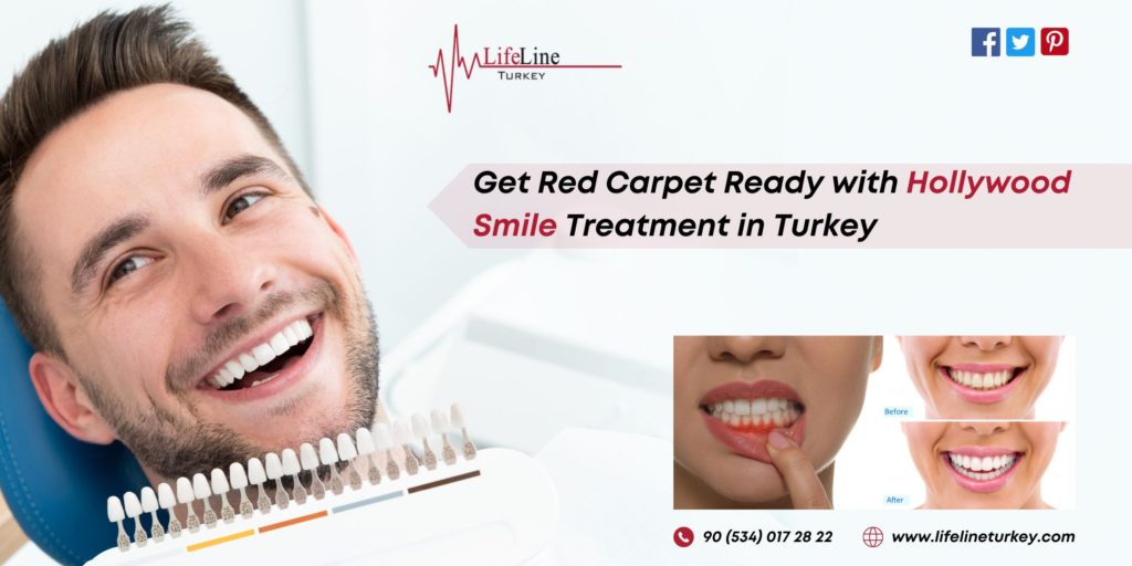 Hollywood Smile Treatment in Turkey