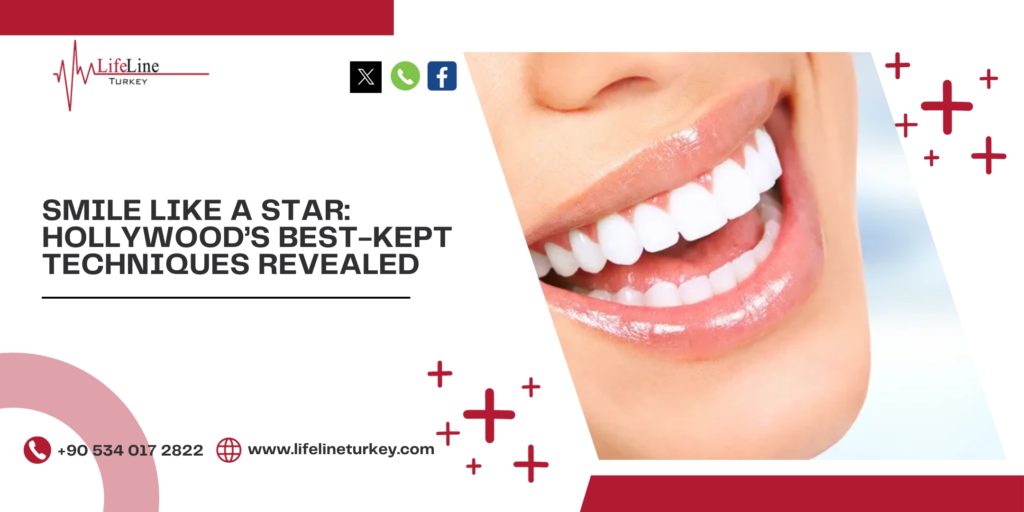 Hollywood Smile Treatment in Turkey
