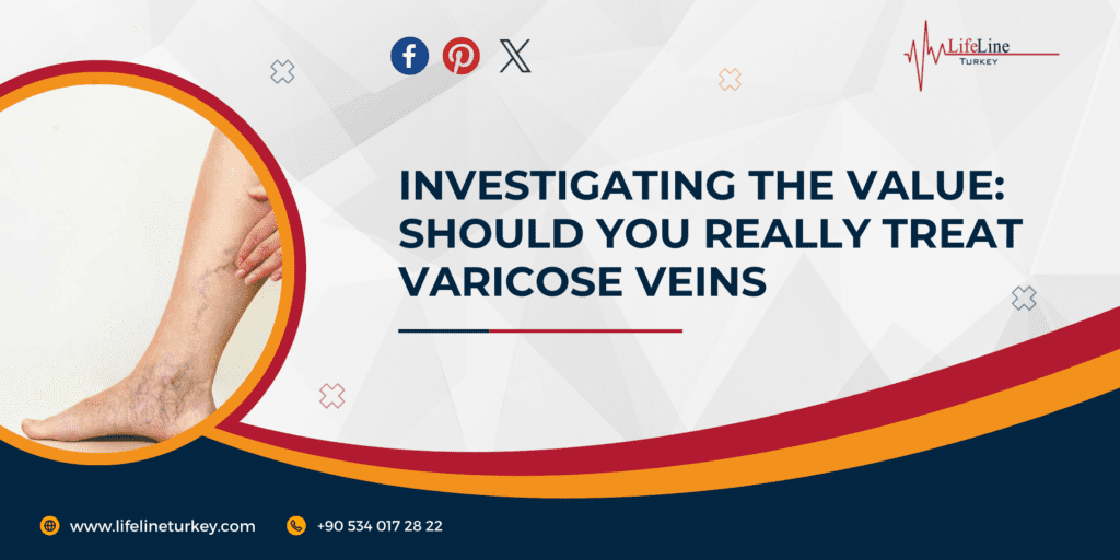 Varicose Vein Laser Treatment in Turkey