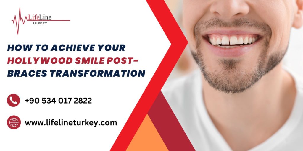 Hollywood smile treatment in Turkey