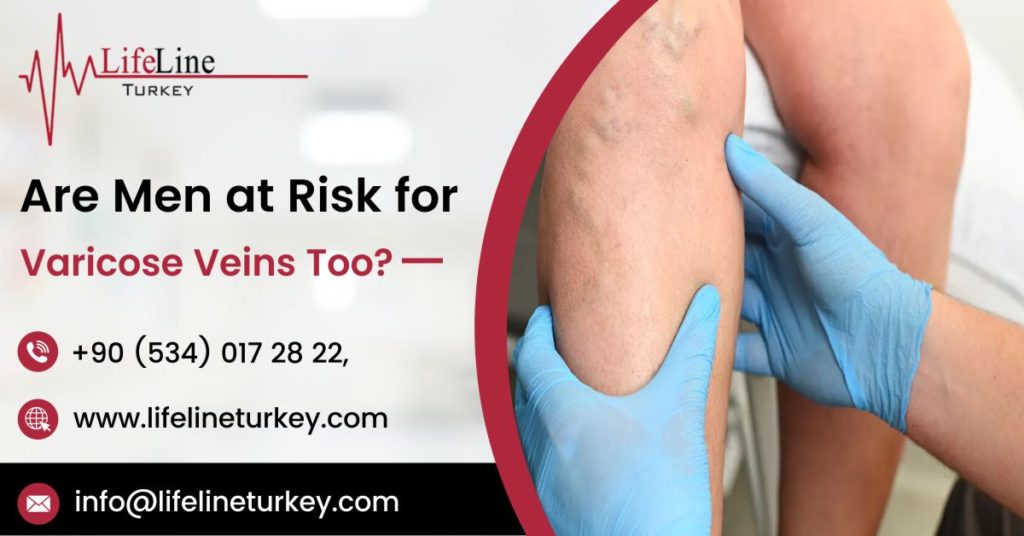 varicose vein treatment costs in Turkey