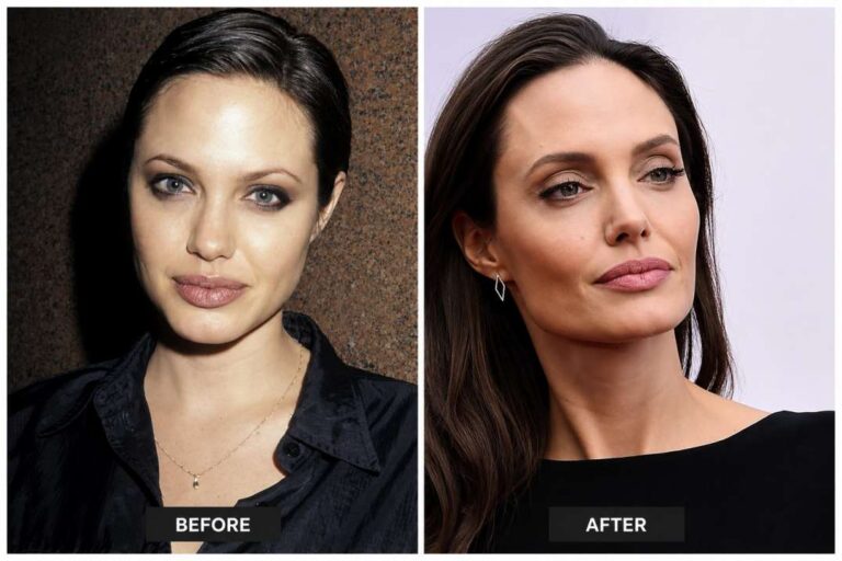 Angelina Jolie’s Changing Appearance: Plastic Surgery or Natural Ageing?