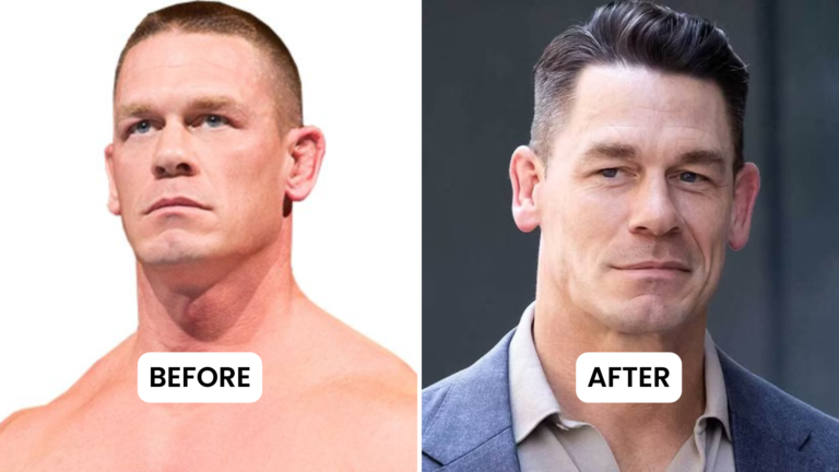 John Cena Hair Transplant: Did the WWE Legend Really Get a Hair Restoration Procedure?