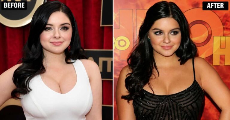 Ariel Winter’s Transformation: Before and After, Cosmetic Surgery Rumours & Beauty Evolution