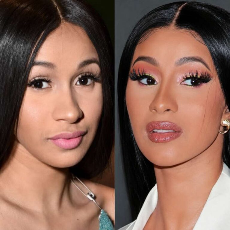 Inside Cardi B’s Cosmetic Transformation: What Has She Had Done?