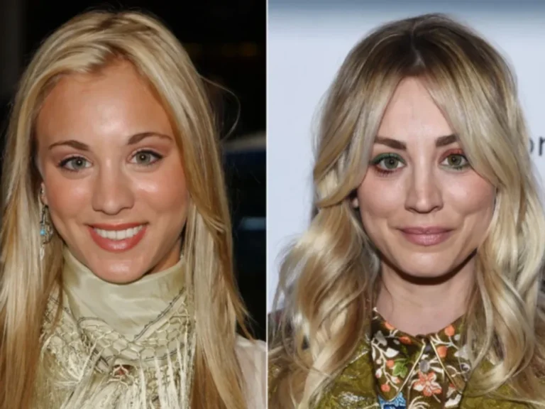 Kaley Cuoco Before and After: Plastic Surgery Rumours Examined